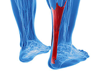 Achilles tendonitis treatment in the Mississauga, ON L5L 5M5 & North York, ON M2J 2K9 Canada areas