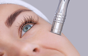 medical esthetic laser services