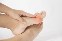 How Runners Can Prevent Bunions