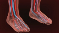 Signs and Causes of Poor Circulation