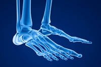 Who Is Prone to Getting Stress Fractures?