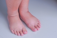Pregnancy and Its Effects on the Feet