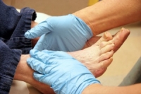 Foot Care Is Essential for Diabetic Patients