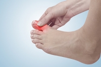 Being at Risk for Gout