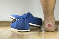 Impact of Foot Blisters on Daily Activity