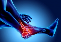 Osteoarthritis in the Feet